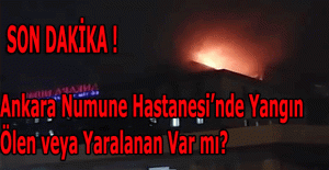 Ankara Numune Hastanesinde yangın! Ölen ve yaralanan var mı?
