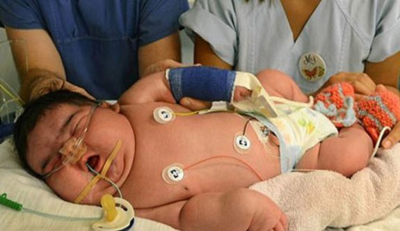 Dünyanın en kilolu bebeği tam 18 kilo