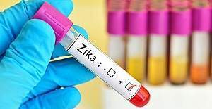 DSÖ, Zika Virüsünü 'küresel acil durum' kapsamından çıkardı